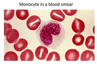 Monocyte in a blood smear
 