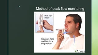 z
Method of peak flow monitoring
 