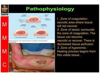 l . Zone of coagulation: 
necrotic area where tissue 
will not recover 
2. Zone of stasis: surrounds 
the zone of coagulation. The 
tissue can become 
necrotic or recover. There is 
decreased tissue perfusion 
3. Zone of hyperemia : 
Healing process begins from 
this viable tissue . 
 