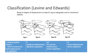 Classification (Levine and Edwards)
Based on degree of displacement on lateral C-spine radiographs and on mechanical
stability
I: bilateral pedicle
fracture
<3mm of anterior C2
body displacement
no angulation
II
significant displacement
significant angulation
IIA
No anterior
displacement
Severe angulation
III
Severe displacement
Severe angulation
 