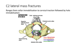 C2 lateral mass fractures
Ranges from collar immobilisation to cervical traction followed by halo
immobilisation.
 