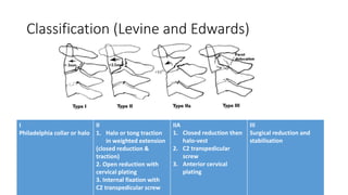 Classification (Levine and Edwards)
I
Philadelphia collar or halo
II
1. Halo or tong traction
in weighted extension
(closed reduction &
traction)
2. Open reduction with
cervical plating
3. Internal fixation with
C2 transpedicular screw
IIA
1. Closed reduction then
halo-vest
2. C2 transpedicular
screw
3. Anterior cervical
plating
III
Surgical reduction and
stabilisation
 