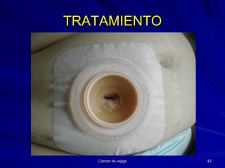 TRATAMIENTO 