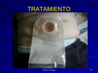 TRATAMIENTO 