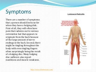 Symptoms
There are a number of symptoms
that a person should look out for
when they have a bulging disk.
First of all, they will often have
pain that radiates out to various
extremities but that appears to
originate from the back because
of the large amount of nerve
endings in the back. Second, there
might be tingling throughout the
body with even tingling fingers
often surprisingly being the result
of a bulging disc. Many bulging
disc sufferers also report
numbness and muscle weakness.
http://www.robertmuscio.com/
 