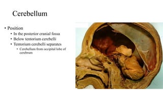 Cerebellum
• Position
• In the posterior cranial fossa
• Below tentorium cerebelli
• Tentorium cerebelli separates
• Cerebellum from occipital lobe of
cerebrum
 