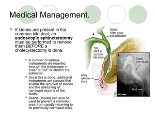 Medical Management.
 If stones are present in the
common bile duct, an
endoscopic sphincterotomy
must be performed to remove
them BEFORE a
cholecystectomy is done.
A number of various
instruments are inserted
through the endoscope in
order to "cut" or stretch the
sphincter.
Once this is done, additional
instruments are passed that
enable the removal of stones
and the stretching of
narrowed regions of the
ducts.
Drains (stents) can also be
used to prevent a narrowed
area from rapidly returning to
its previously narrowed state.
 