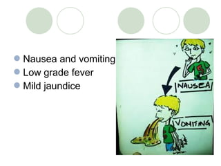 Nausea and vomiting
Low grade fever
Mild jaundice
 