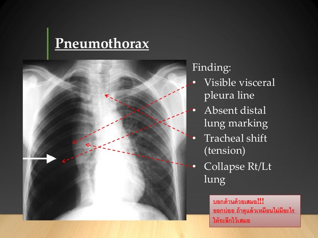 CXR and abdominal film interpretation for medical student