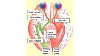 Cortical Vision Impairment Ellen Mazel