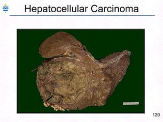 Other agents that produce such injury are carbon tetrachloride, acetaminophen, toxins of the mushroom Amanita phalloides.