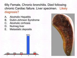 94MRI Cirrhosis