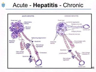 Hepatorenal syndromeDecreased Albumin synthesisHepatorenal syndrome