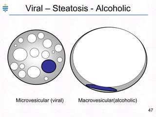 Jaundice in liver failure18