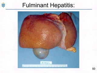 21Viral Hepatitis: IntroductionViral Hepatitis:Specific – Heptitis B, C, D (serum),A, ENon-Specific -  Many viruses CMV, EBV, etc.Acute, Chronic (CPH, CAH), Fulminant.Specific viral hepatitis important cause of morbidity & mortality.Horizontal transmission – Blood.. Sex.Vertical transmission – Mother to fetus.Hepatitis  Cirrhosis  Hepatic Ca. (not in A/E)