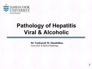 7Pathology of HepatitisViral & AlcoholicDr. Venkatesh M. Shashidhar.Assoc.Prof  & Head of Pathology