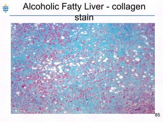 Laboratory DiagnosisViral Hepatitis