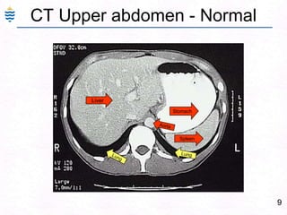 9CT Upper abdomen - NormalLiverStomachAortaSpleenLungLung