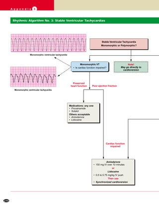 270
A p p e n d i x 3
Stable Ventricular Tachycardia
Monomorphic or Polymorphic?
Amiodarone
• 150 mg IV over 10 minutes
or
Lidocaine
• 0.5 to 0.75 mg/kg IV push
Then use
• Synchronized cardioversion
Monomorphic VT
• Is cardiac function impaired?
Medications: any one
• Procainamide
• Sotalol
Others acceptable
• Amiodarone
• Lidocaine
Note!
May go directly to
cardioversion
Poor ejection fraction
Cardiac function
impaired
Preserved
heart function
Monomorphic ventricular tachycardia
Rhythmic Algorithm No. 3: Stable Ventricular Tachycardias
Monomorphic ventricular tachycardia
 