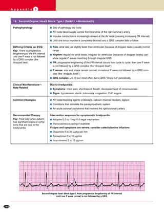 280
A p p e n d i x 3
18. Second-Degree Heart Block Type I (Mobitz I–Wenkebach)
s Rate: atrial rate just slightly faster than ventricular (because of dropped beats); usually normal
range
s Rhythm: regular for atrial beats; irregular for ventricular (because of dropped beats); can
show regular P waves marching through irregular QRS
s PR: progressive lengthening of the PR interval occurs from cycle to cycle; then one P wave
is not followed by a QRS complex (the “dropped beat”)
s P waves: size and shape remain normal; occasional P wave not followed by a QRS com-
plex (the “dropped beat”)
s QRS complex: ≤0.10 sec most often, but a QRS “drops out” periodically
Clinical Manifestations—
Rate-Related
Common Etiologies s AV nodal blocking agents: β-blockers, calcium channel blockers, digoxin
s Conditions that stimulate the parasympathetic system
s An acute coronary syndrome that involves the right coronary artery
Recommended Therapy
Key: Treat only when patient
has significant signs or symp-
toms that are due to the
bradycardia
Pathophysiology s Site of pathology: AV node
s AV node blood supply comes from branches of the right coronary artery
s Impulse conduction is increasingly slowed at the AV node (causing increasing PR interval)
s Until one sinus impulse is completely blocked and a QRS complex fails to follow
Due to bradycardia:
s Symptoms: chest pain, shortness of breath, decreased level of consciousness
s Signs: hypotension, shock, pulmonary congestion, CHF, angina
Intervention sequence for symptomatic bradycardia:
s Atropine 0.5 to 1 mg IV if vagal mechanism
s Transcutaneous pacing if available
If signs and symptoms are severe, consider catecholamine infusions:
s Dopamine 5 to 20 µg/kg per min
s Epinephrine 2 to 10 µg/min
s Isoproterenol 2 to 10 µg/min
Defining Criteria per ECG
Key: There is progressive
lengthening of the PR interval
until one P wave is not followed
by a QRS complex (the
dropped beat)
Second-degree heart block type I. Note progressive lengthening of PR interval
until one P wave (arrow) is not followed by a QRS.
 