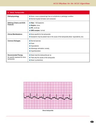 ACLS Rhythms for the ACLS Algorithms
257
5. Sinus Tachycardia
Defining Criteria and ECG
Features
s Rate: >100 beats/min
s Rhythm: sinus
s PR: ≤0.20 sec
s QRS complex: normal
Clinical Manifestations s None specific for the tachycardia
s Symptoms may be present due to the cause of the tachycardia (fever, hypovolemia, etc)
Common Etiologies s Normal exercise
s Fever
s Hypovolemia
s Adrenergic stimulation; anxiety
s Hyperthyroidism
Recommended Therapy
No specific treatment for sinus
tachycardia
s Never treat the tachycardia per se
s Treat only the causes of the tachycardia
s Never countershock
Pathophysiology s None—more a physical sign than an arrhythmia or pathologic condition
s Normal impulse formation and conduction
Sinus tachycardia
 