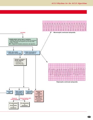 ACLS Rhythms for the ACLS Algorithms
259
3. Stable wide-complex
tachycardia: unknown type
DC cardioversion
or
Procainamide
or
Amiodarone
DC cardioversion
or
Amiodarone
4. Stable monomorphic VT
and/or polymorphic VT
Confirmed
SVT
Confirmed
stable VT
Wide-complex
tachycardia of
unknown type
Attempt to establish a
specific diagnosis
• 12-lead ECG
• Esophageal lead
• Clinical information
Treatment of
stable
monomorphic
and
polymorphic VT
(See stable VT:
monomorphic
and polymorphic
algorithm)
Unstable patient: serious signs or symptoms
• Establish rapid heart rate as cause of signs and symptoms
• Rate-related signs and symptoms occur at many rates,
seldom <150 bpm
• Prepare for immediate cardioversion (see algorithm)
Unstable
Preserved
cardiac function
Ejection fraction <40%
Clinical CHF
Monomorphic ventricular tachycardia
Polymorphic ventricular tachycardia
 