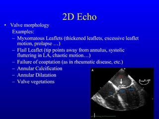 2D Echo Valve morphology Examples: Myxomatous Leaflets (thickened leaflets, excessive leaflet motion, prolapse …) Flail Leaflet (tip points away from annulus, systolic fluttering in LA, chaotic motion…) Failure of coaptation (as in rheumatic disease, etc.) Annular Calcification Annular Dilatation Valve vegetations 