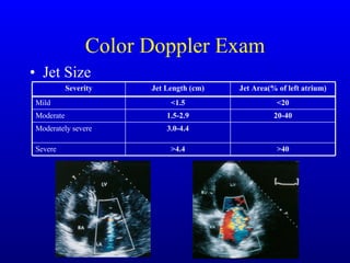 Color Doppler Exam Jet Size >40 >4.4 Severe 3.0-4.4 Moderately severe 20-40 1.5-2.9 Moderate <20 <1.5 Mild Jet Area(% of left atrium) Jet Length (cm) Severity 