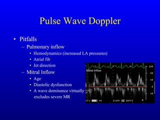 Pulse Wave Doppler Pitfalls Pulmonary inflow Hemodynamics (increased LA pressures) Atrial fib Jet direction Mitral Inflow Age Diastolic dysfunction A wave dominance virtually excludes severe MR 