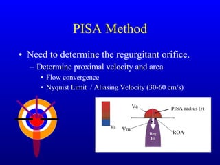 PISA Method Need to determine the regurgitant orifice. Determine proximal velocity and area Flow convergence Nyquist Limit  / Aliasing Velocity (30-60 cm/s) Vmr ROA 