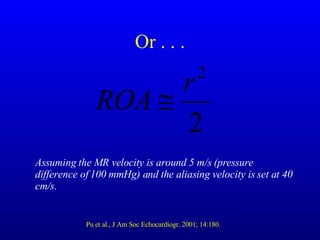 Or . . . Assuming the MR velocity is around 5 m/s (pressure difference of 100 mmHg) and the aliasing velocity is set at 40 cm/s. Pu et al., J Am Soc Echocardiogr. 2001; 14:180. 