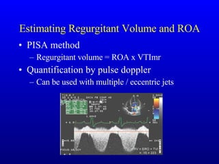 Estimating Regurgitant Volume and ROA PISA method Regurgitant volume = ROA x VTImr Quantification by pulse doppler Can be used with multiple / eccentric jets 