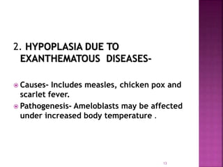 2. HYPOPLASIA DUE TO
EXANTHEMATOUS DISEASES-
 Causes- Includes measles, chicken pox and
scarlet fever.
 Pathogenesis- Ameloblasts may be affected
under increased body temperature .
13
 