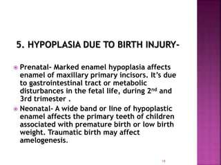 5. HYPOPLASIA DUE TO BIRTH INJURY-
 Prenatal- Marked enamel hypoplasia affects
enamel of maxillary primary incisors. It’s due
to gastrointestinal tract or metabolic
disturbances in the fetal life, during 2nd and
3rd trimester .
 Neonatal- A wide band or line of hypoplastic
enamel affects the primary teeth of children
associated with premature birth or low birth
weight. Traumatic birth may affect
amelogenesis.
19
 