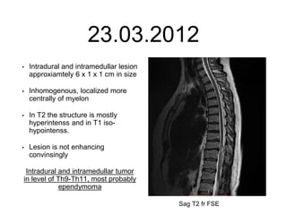 23.03.2012
• Intradural and intramedullar lesion
approxiamtely 6 x 1 x 1 cm in size
• Inhomogenous, localized more
centrally of myelon
• In T2 the structure is mostly
hyperintenss and in T1 iso-
hypointenss.
• Lesion is not enhancing
convinsingly
Intradural and intramedullar tumor
in level of Th9-Th11, most probably
ependymoma
Sag T2 fr FSE
 