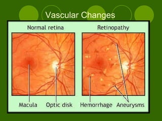 Vascular Changes 