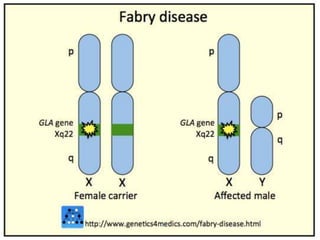 Fabry disease