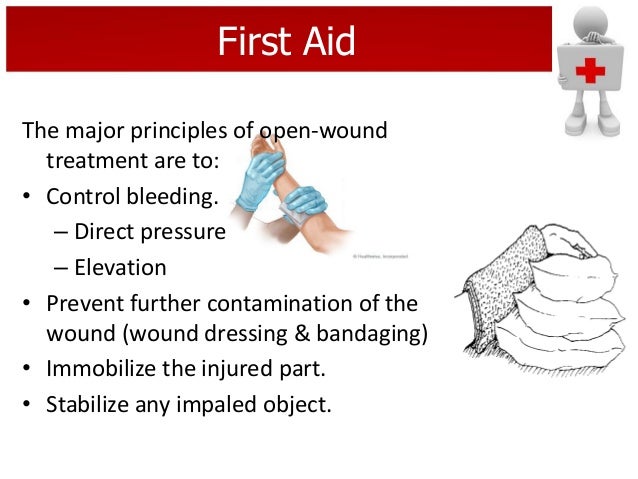 Wound 3 формы: найдено 86 изображений