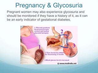 Pregnancy & Glycosuria
Pregnant women may also experience glycosuria and
should be monitored if they have a history of it, as it can
be an early indicator of gestational diabetes.
 