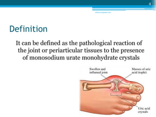 Definition 
It can be defined as the pathological reaction of 
the joint or periarticular tissues to the presence 
of monosodium urate monohydrate crystals 
4 
sriloy21@gmail.com 
 