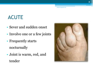 ACUTE 
• Sever and sudden onset 
• Involve one or a few joints 
• Frequently starts 
nocturnally 
• Joint is warm, red, and 
tender 
8 
sriloy21@gmail.com 
 