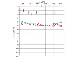 Frequency (Hz)
250 500 1000 2000 4000 8000
-10
Intensity(dBHL)
0
10
20
30
40
50
60
70
80
90
100
110
120
O O O
O O O O
O
[
[ [
[
[
]
]
]
]
]
X
X
X X X
X
X
X
 