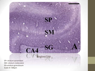 Region CA4
SP= stratum pyramidale
SM= stratum moleculare
SG=stratum granulosum
Scale A= 500µm
 