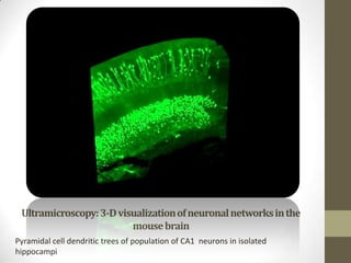 Ultramicroscopy: 3-D visualization of neuronal networks in the
                         mouse brain
Pyramidal cell dendritic trees of population of CA1 neurons in isolated
hippocampi
 