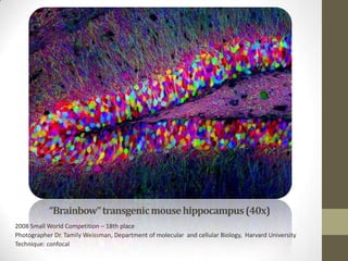 “Brainbow” transgenic mouse hippocampus (40x)
2008 Small World Competition – 18th place
Photographer Dr. Tamily Weissman, Department of molecular and cellular Biology, Harvard University
Technique: confocal
 