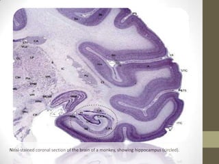 Nissl-stained coronal section of the brain of a monkey, showing hippocampus (circled).
 