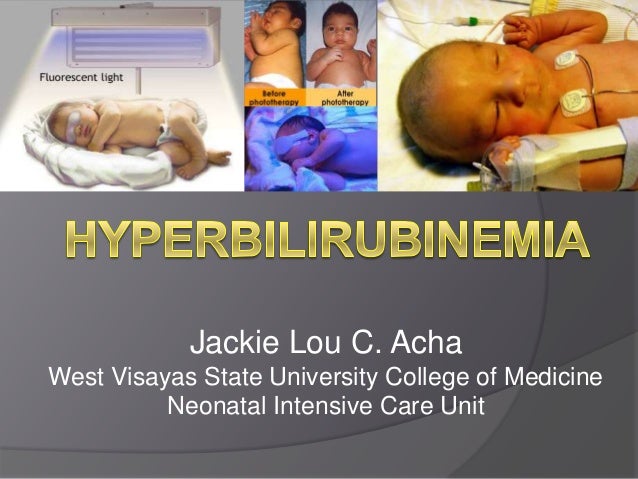 Hyperbilirubinemia Neonatal Neonatal Hyperbilirubinem - vrogue.co