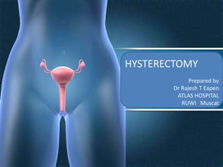 Hysterectomy | PPT