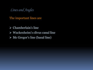 Lines and Angles
The important lines are
 Chamberlain’s line
 Wackenheim’s clivus canal line
 Mc Gregor’s line (basal line)

 