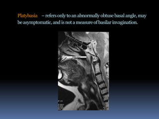 Platybasia – refers only to an abnormally obtuse basal angle, may
be asymptomatic, and is not a measure of basilar invagination.

 